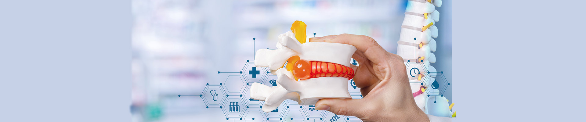 Κήλη Μεσοσπονδύλιου Δίσκου