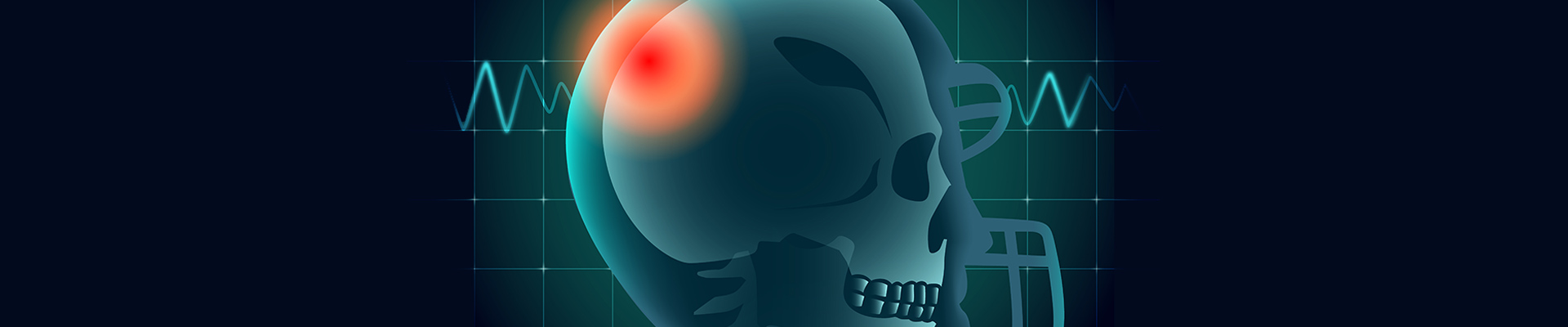 Κρανιοεγκεφαλικές Κακώσεις