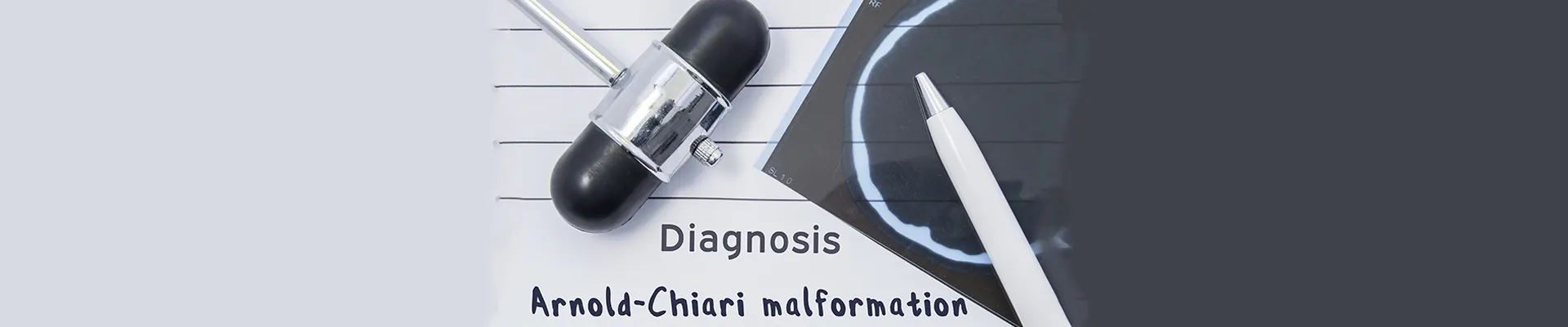 Δυσπλασία Arnold Chiari