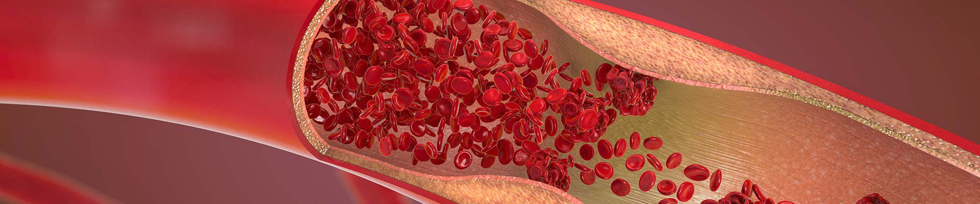 Σηραγγώδεις Δυσπλασίες